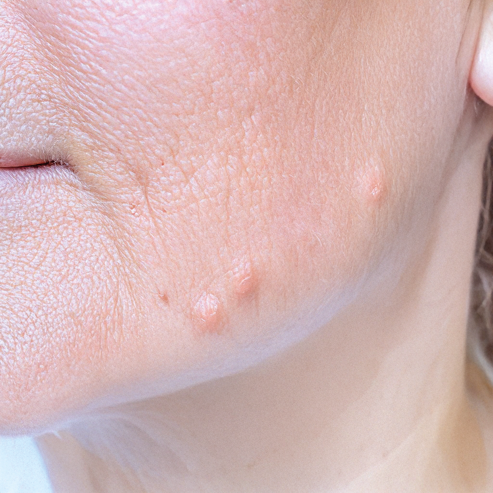 Damaged skin
