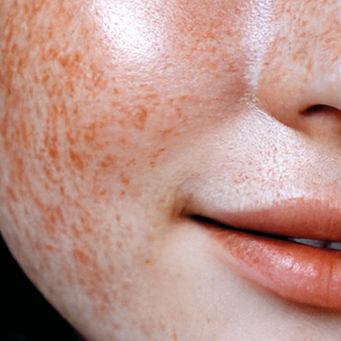 Demanding skin