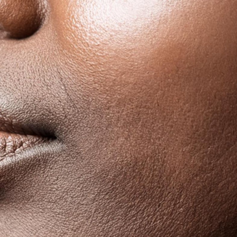 Dry skin