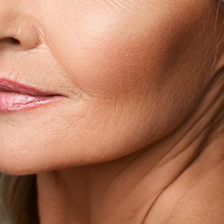 Mature skin